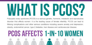 PCOS