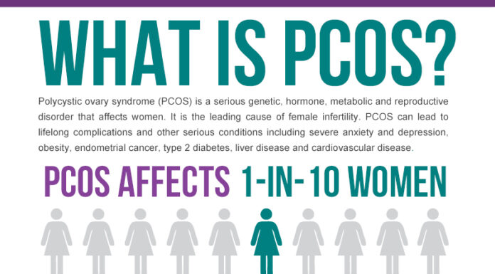 PCOS